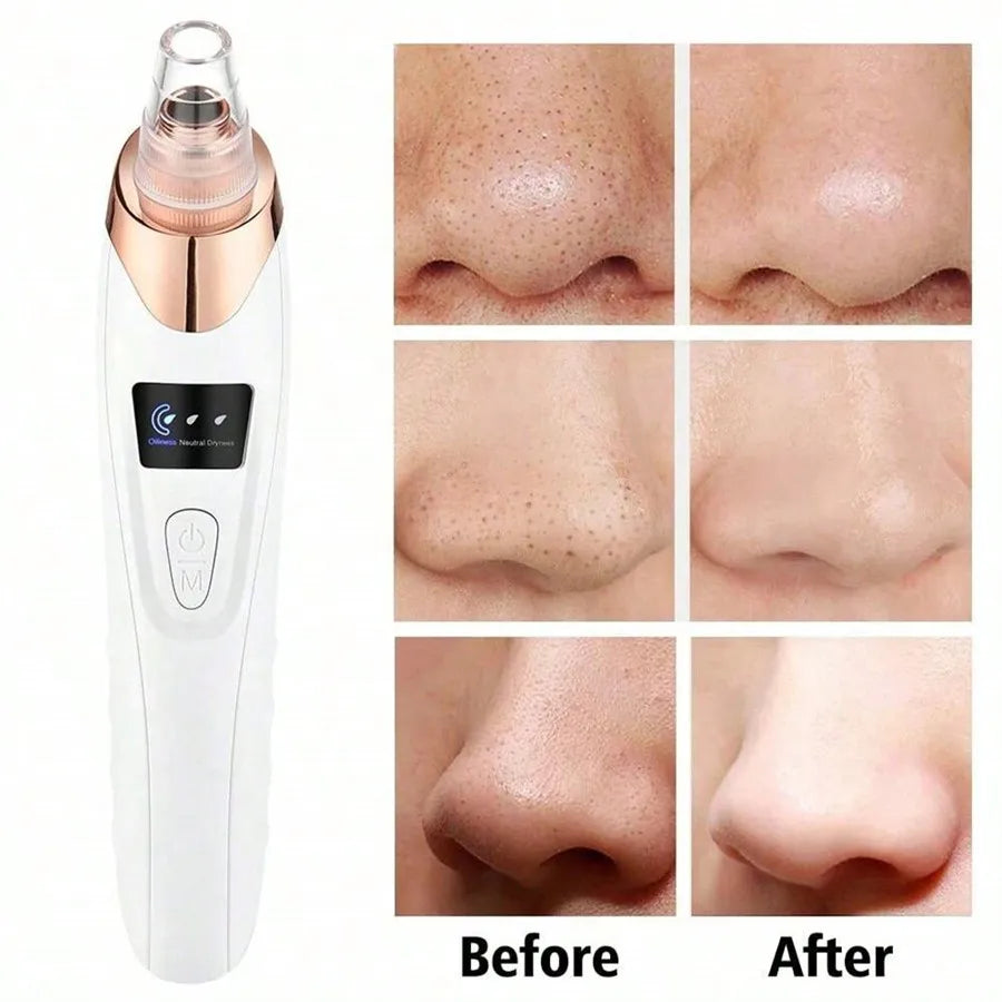 Marcival Hill ClearSkin Pro - Blackhead Remover